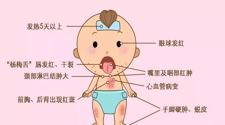 小儿咳嗽分几种类型怎么区分,小儿咳嗽分为哪几种类型